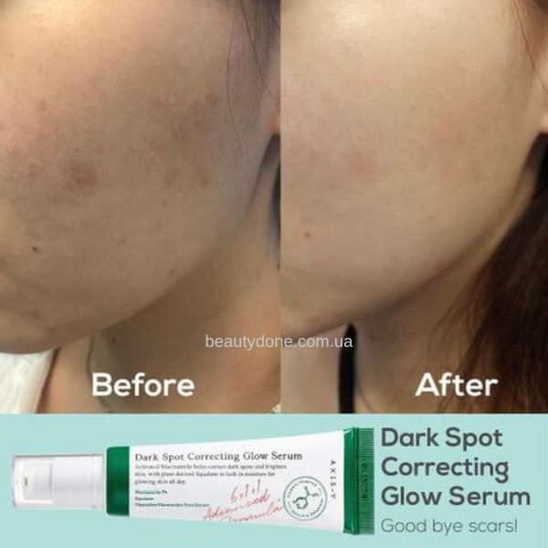 Восстанавливающая сыворотка для проблемной кожи AXIS-Y dark spot correcting glow serum 50 мл 2348 фото