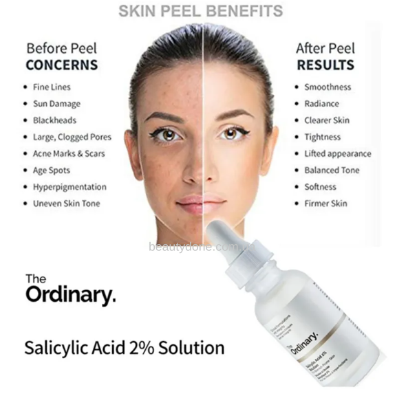 Сироватка з саліциловою кислотою The Ordinary Salicylic Acid 2% Solution 30 ml 3866 фото