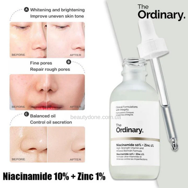 Сироватка з ніацинамідом та цинком THE ORDINARY Niacinamide 10% + Zinc PCA 1% 30 ml 2936 фото