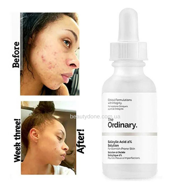 Сыворотка с салициловой кислотой The Ordinary Salicylic Acid 2% Solution 30 ml 3866 фото