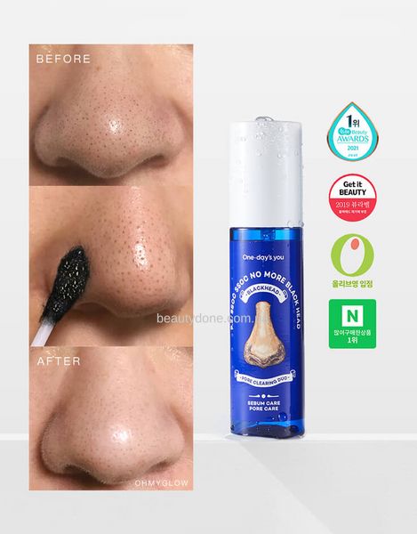 Тонер з кислотами проти чорних цяток One-day's you P.Z. Ssoc Ssoc No More Blackhead 100 ml 0567 фото