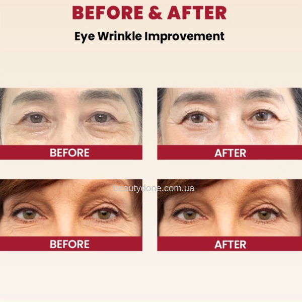 Крем для шкіри навколо очей з ретинолом SEOUL 1988 Eye Cream : Retinal Liposome 4% + Fermented Bean 30ml (термін придатності до 10.08.2027) sale_6585 фото