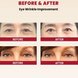 Крем для шкіри навколо очей з ретинолом SEOUL 1988 Eye Cream : Retinal Liposome 4% + Fermented Bean 30ml (термін придатності до 10.08.2027) sale_6585 фото 3