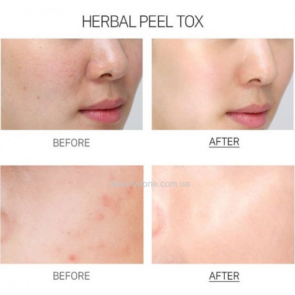 Очищающая пилинг-маска для лица Medi-Peel Herbal Peel Tox Wash Off Type Cream Mask 120 мл 2689 фото