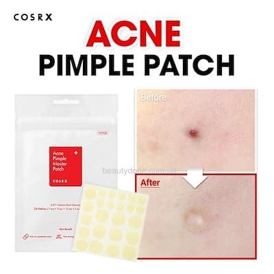 Протизапальні пластирі від прищів COSRX Acne Pimple Master Patch 24 шт 12698 фото