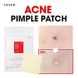 Противовоспалительные пластыри от прыщей Cosrx Acne Pimple Master Patch 24 шт 12698 фото 2